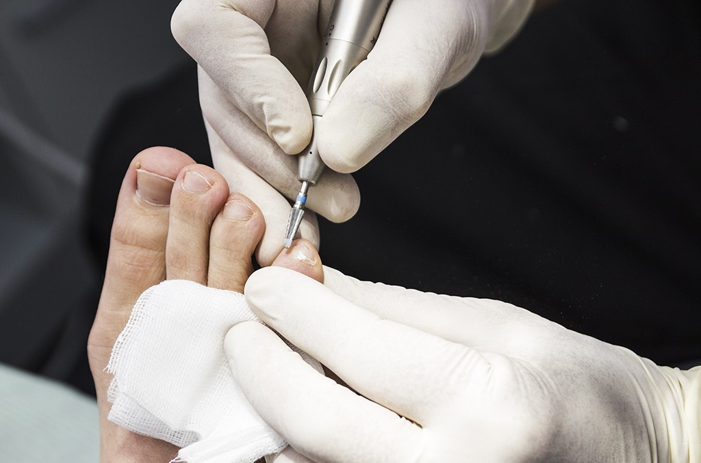 Podología Sanitas y Caser en Premium Madrid